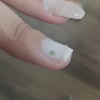 Meri Beauty Center Protez Tırnak Sonrası Enfeksiyon!