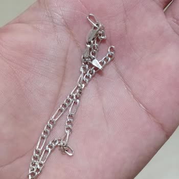 So Chic Bilekliğimin Devamlı Sorunu