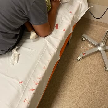 Koç Üniversitesi Hastanesi Acil Hemşiresinden Resmen Dayak Yedik