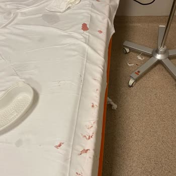 Koç Üniversitesi Hastanesi Acil Hemşiresinden Resmen Dayak Yedik