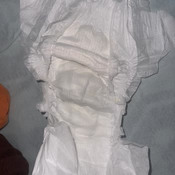 Molfix Pure Soft Sızdırması