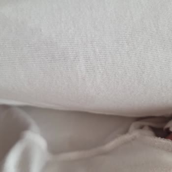 Molfix Bezi Sızdırma Yapıyor