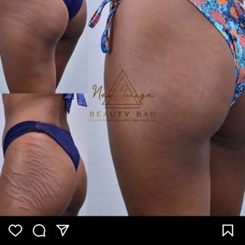 Özgür Özer (ozgurozer.com.tr) Çatlak Yalanı!