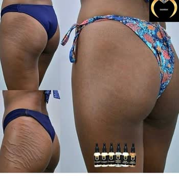 Özgür Özer (ozgurozer.com.tr) Çatlak Yalanı!