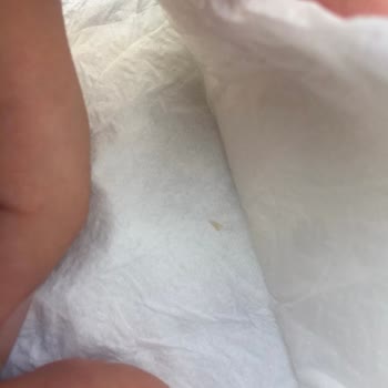 Maksident Ağız Ve Diş Sağlığı Polikliniği Yaptığı Dolgunun Ardında Durmaması