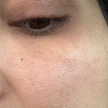 Ahsenvip Güzellik Salonu (Tekirdağ) Memnuniyetsizliği