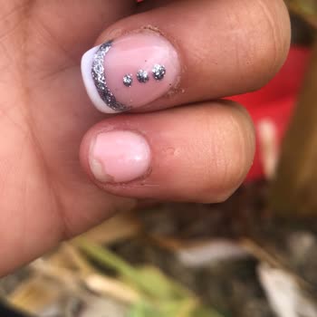 Gold Nails Trabzon Tırnaklarımın Durumu!