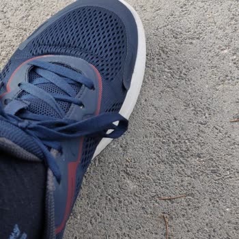 Skechers Üretim Hatası Ve Aldatmaca 2 Yıl Garanti