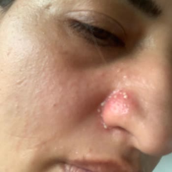 Batı Hastanesi Doktorun Hatası Hastalığımı Kötüye Götürdü