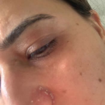 Batı Hastanesi Doktorun Hatası Hastalığımı Kötüye Götürdü