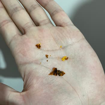 Fritolay Doritos Cipsten Yabancı Madde Çıktı!