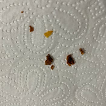Fritolay Doritos Cipsten Yabancı Madde Çıktı!