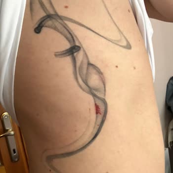 Estenbul Beauty Center Lazerde Dövmemi Yaktılar!