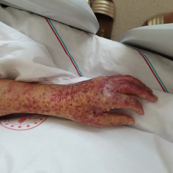 Medical Park Hastanesi Yoğun Bakım Da Hastam Bakılmadı