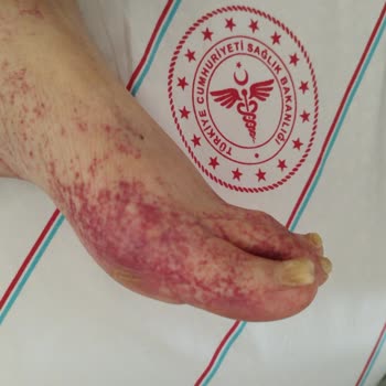 Medical Park Hastanesi Yoğun Bakım Da Hastam Bakılmadı