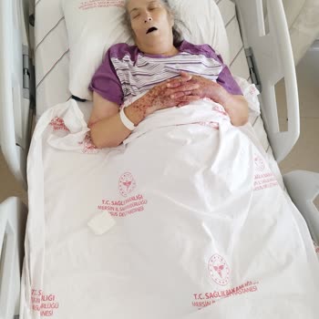 Medical Park Hastanesi Yoğun Bakım Da Hastam Bakılmadı