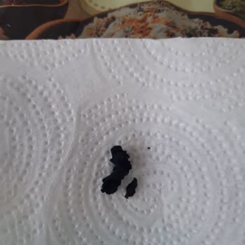 A101 Bendo Marka Çorum Mantısından Plastik Parça Çıktı