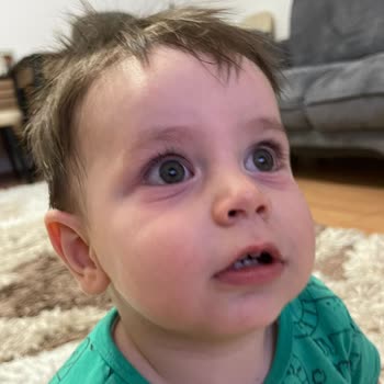 Mustela Güneş Kremi Alerji
