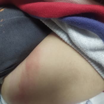 Sleepy Natural Sızma Ve Pişik Sorunu