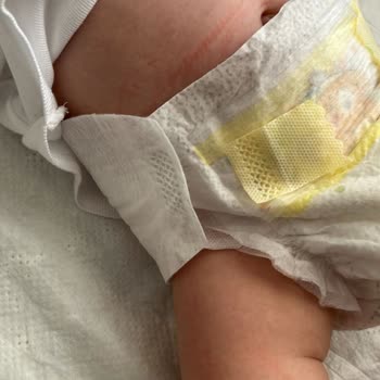 Prima Premium Care 4 Numara Bez Sürekli Kopuyor
