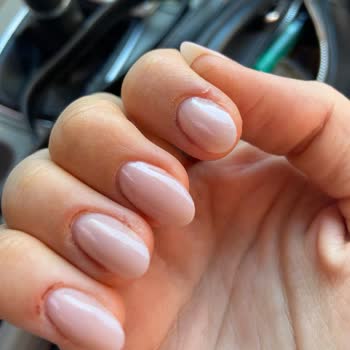 Sisters Beauty Club (Çorlu) Etlerim Apse Enfeksiyon, Acıdan Öldüm
