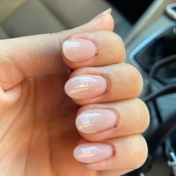 Sisters Beauty Club (Çorlu) Etlerim Apse Enfeksiyon, Acıdan Öldüm