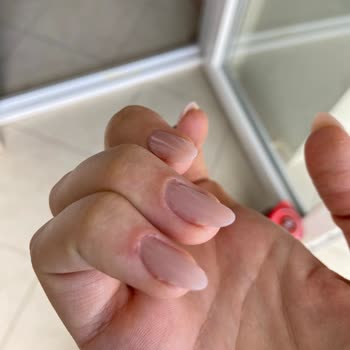 Sisters Beauty Club (Çorlu) Etlerim Apse Enfeksiyon, Acıdan Öldüm