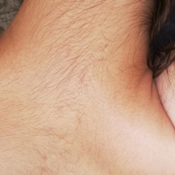 Suit Güzellik Merkezleri Afyon Sonuç Alamadım