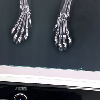 Hüseyingazi Veteriner Kliniği Hatası