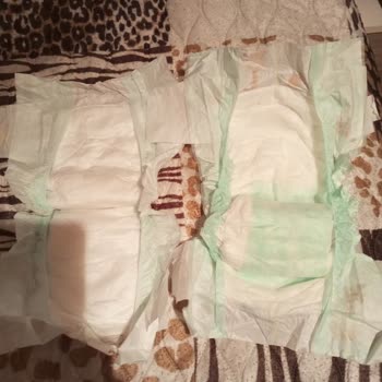 Baby Me Bebek Bezi Problemli Paketler