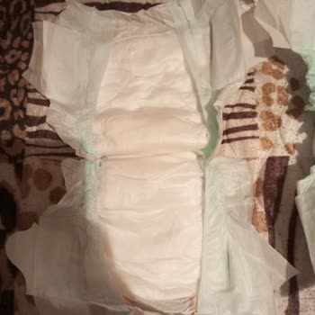 Baby Me Bebek Bezi Problemli Paketler