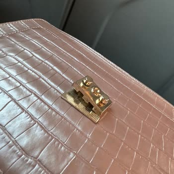 Tamer Tanca Çanta Kulpunun, Aksesuarların Kopması!