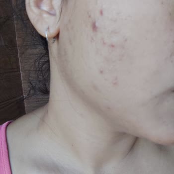 Institut Esthederm Esthederm Retinol Serum Cildimi Mahvetti