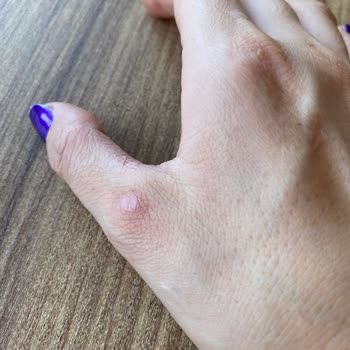 Dyson Almanın Verdiği Pişmanlık