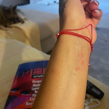 Ti Design Studio Alerji Yapıyor İade Almamak İçin Her Şeyi Yapıyor