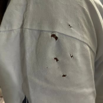 Samsung Çamaşır Makinesi Çamaşırları Deliyor