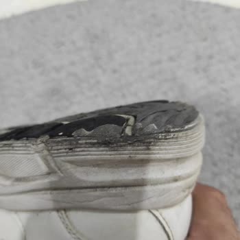 Skechers Ayakkabı Tabanı Aşınma