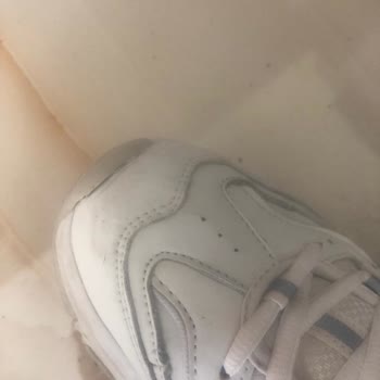 Skechers Ayakkabıdaki 5 Aydaki Deformasyon