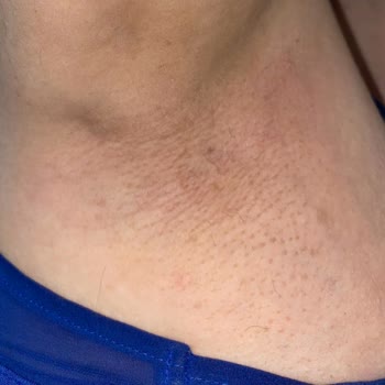 Deniz Kızı Güzellik Evi (Vize) Zarara Uğratma Ve Yalan Beyan