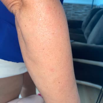 Deniz Kızı Güzellik Evi (Vize) Zarara Uğratma Ve Yalan Beyan