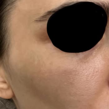 Dr. Neslihan Dolar'ın Uyguladığı Yanlış Tedavi