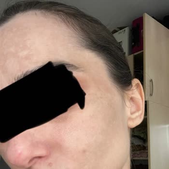 Dr. Neslihan Dolar'ın Uyguladığı Yanlış Tedavi