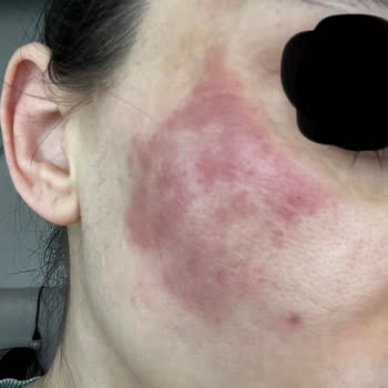 Dr. Neslihan Dolar'ın Uyguladığı Yanlış Tedavi