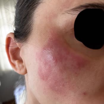 Dr. Neslihan Dolar'ın Uyguladığı Yanlış Tedavi