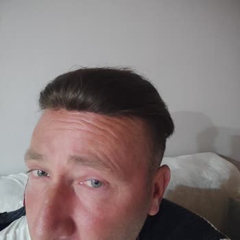 Hairex Protez Saç Saç Değil Resmen Peruk