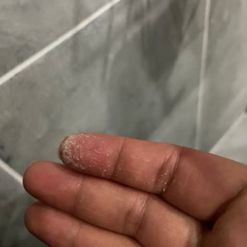 Vanish Kosla Leke Çıkarıcı Elimi Yaktı