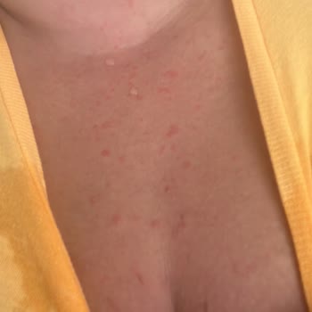 Özel Birlik Hastanesi Yanlış Tedavi Ve İlaç