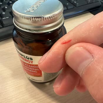 Youplus Kapaklar Değişmeli!