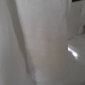 Molfix Bez İdrar Çıkartıyor