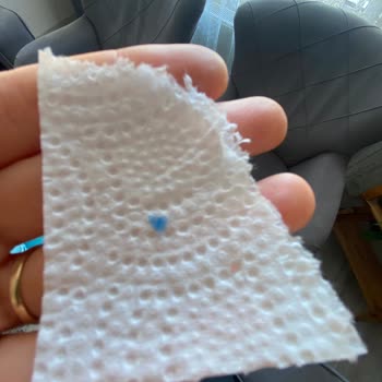 Banvit Salamın İçinden Yabancı Cisim Çıktı